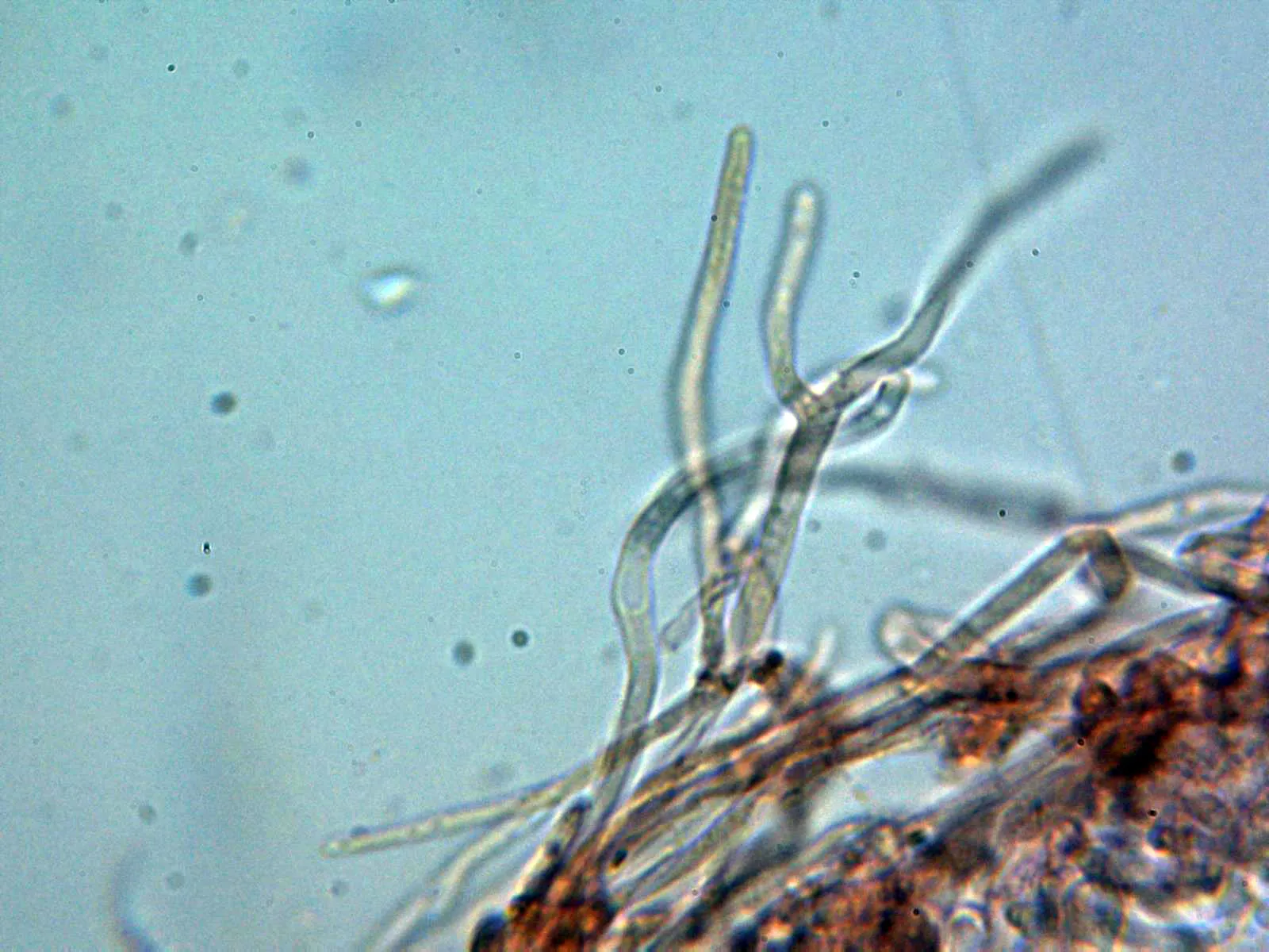 Microscopía de Pellidiscus pallidus - 10 - Pelos externos 1